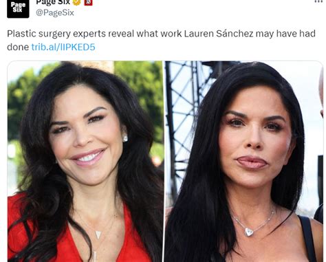 lauren sanchez surgery|Exclusive 